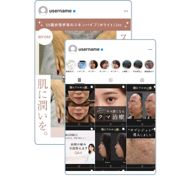 症例写真/動画が売上を作る