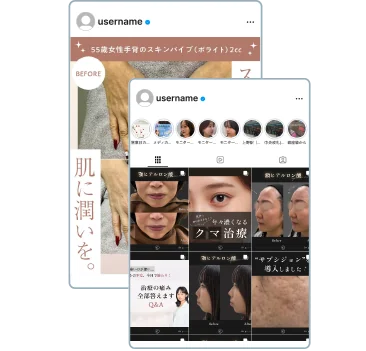 症例写真/動画が売上を作る