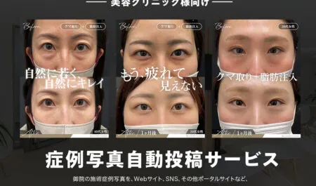 症例写真・症例動画 運用の課題を解決！MPH×Crackin共同開発「症例写真自動投稿サービス」でWEB集患を最大化