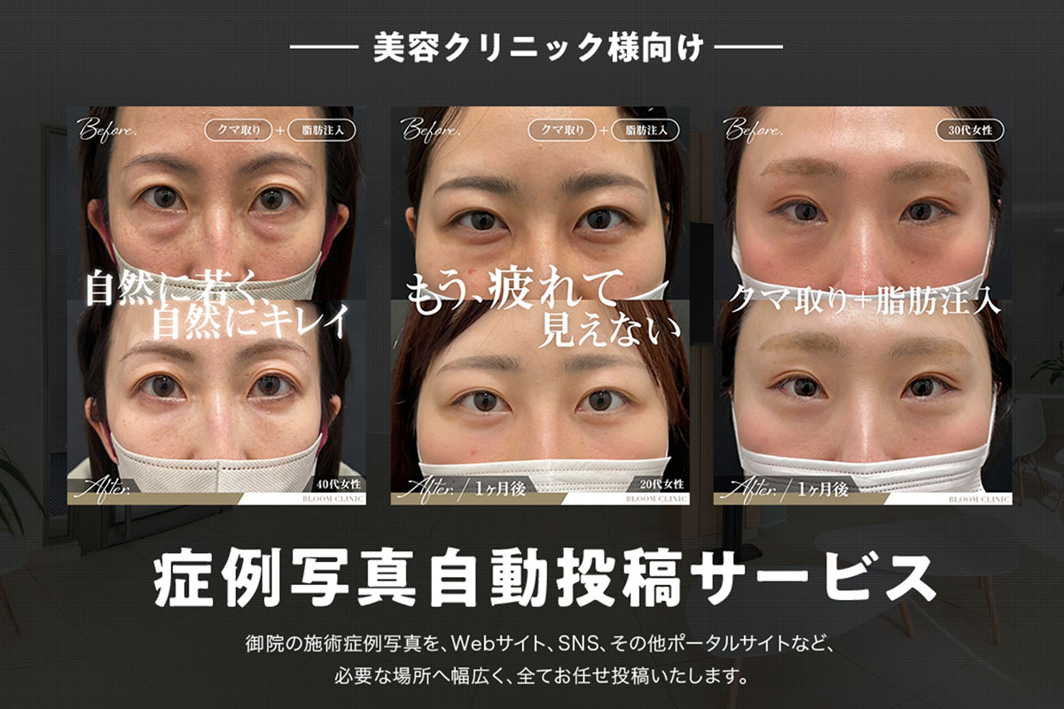 症例写真自動投稿サービス