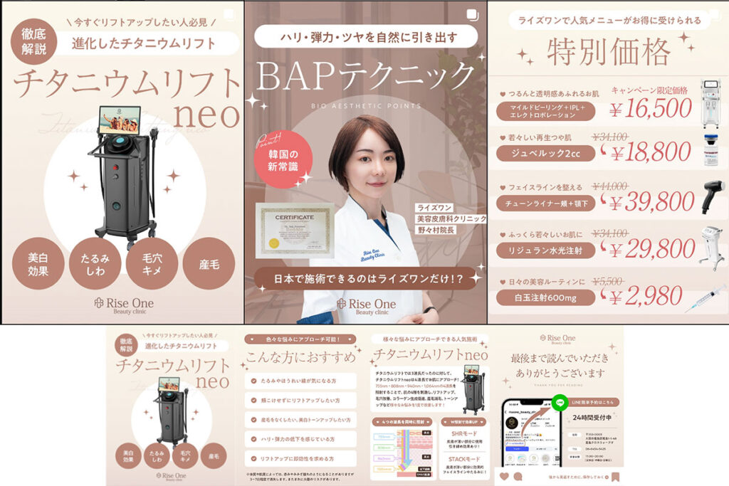 ライズワン美容皮膚科クリニック様_Instagram投稿