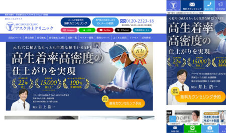 激戦の植毛市場で「セッション数 約4倍」「予約数 昨年対比大幅増」を達成