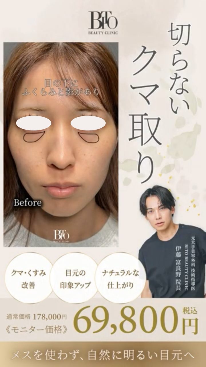 MPHが制作した美容クリニック動画広告クリエイティブ 1
